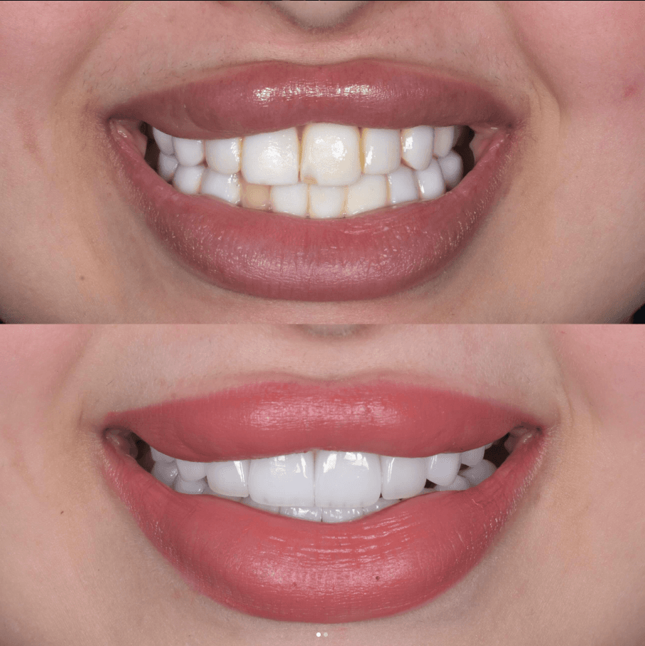 Sourire harmonisé au HB Dental Center à Casablanca
